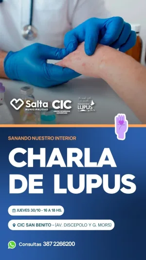 CHARLA DE LUPUS